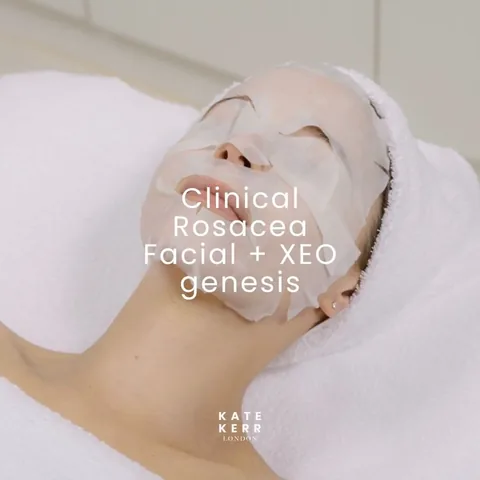 katekerrlondon_facialist Instagram post about Rosacea treatment