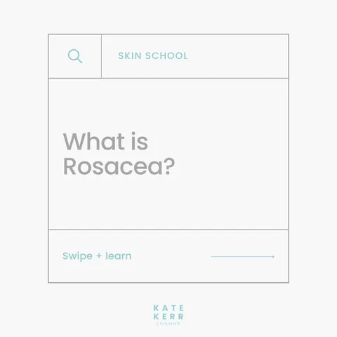 katekerrlondon_facialist Instagram post about Rosacea overview